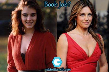 Elizabeth Hurley Plastic Surgery, Boob Job, Botox, Before After Pics ...