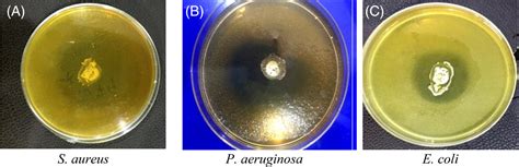 In Vivo Assessment Of Lactobacillus Plantarum And Cocultured Cells On