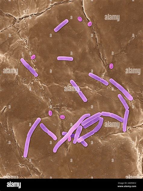 Coloured Scanning Electron Micrograph Sem Of Bacillus Anthracis Spore