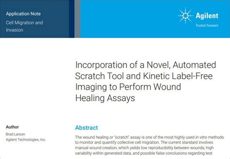 In Vitro Cell Migration Assays