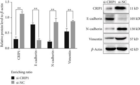 The Relationship Between CRIP1 And EMT Indicates That CRIP1 May