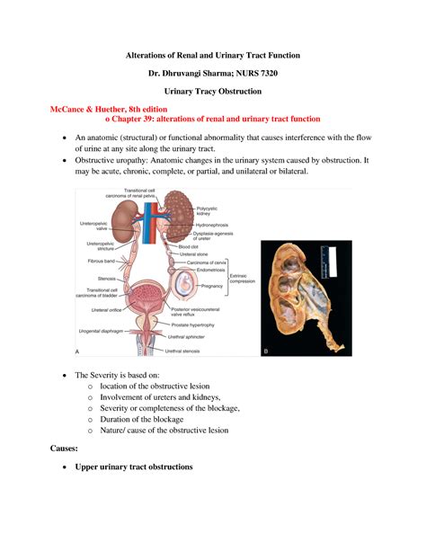 Renal Alteration Part 1 Alterations Of Renal And Urinary Tract