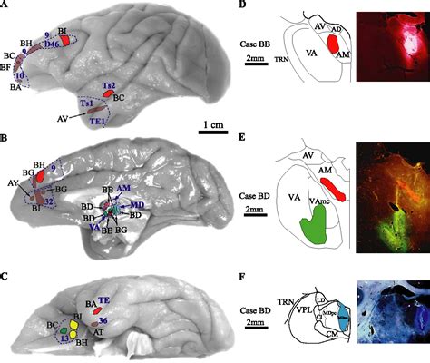 Figure 1 From Prefrontal Projections To The Thalamic Reticular Nucleus Form A Unique Circuit For