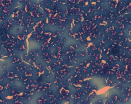 Positive Cp Control S Aureus Isolate H Stained By Modified