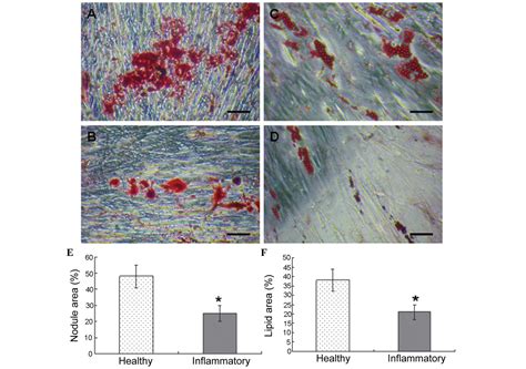 Periodontitis Promotes The Proliferation And Suppresses The