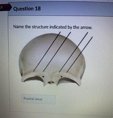 Solved Name The Structure Indicated By The Arrow Chegg