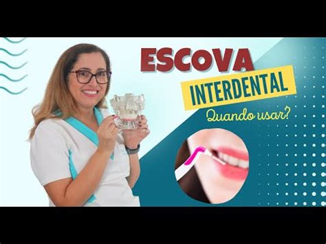 Como Utilizar A Escova Interdental Corretamente Adornare Odontologia