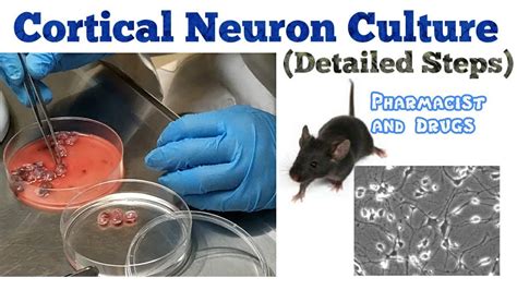 Mouse Cortical Neuron Culture Research Technique Pharmacist And Drugs