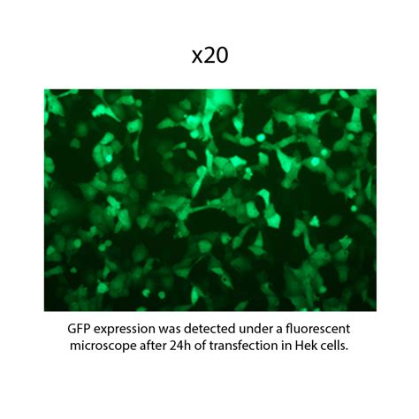 Gfp Mrna Reporter Gene Mrna