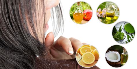 5 Home Remedies For Dandruff Herbalsinfo