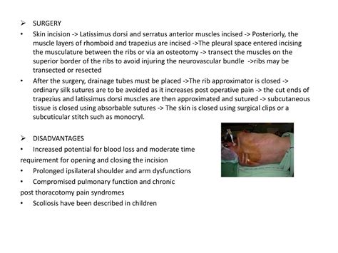 thoracic surgery | PPT