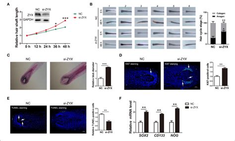 The Ratio Of Hair Follicle Growth After Zyx Knockdown In Vitro A