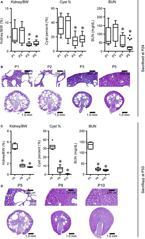 The Timing Of Pkd1 Deletion Modifies The Pattern Of Cyst Formation In