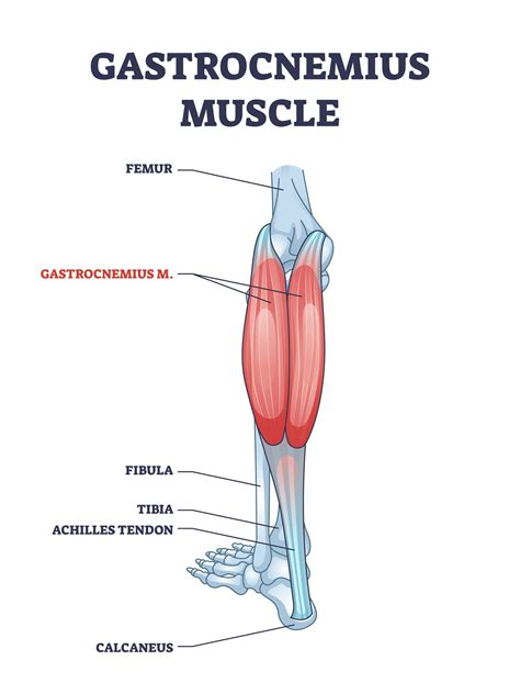 Gastrocnemius Recession | Synergy Health Partners