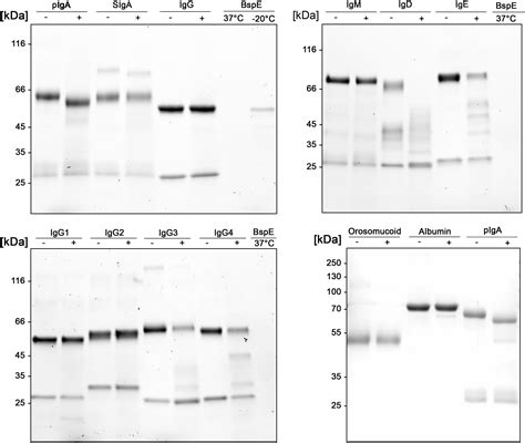 Frontiers A Novel Broad Spectrum Elastase Like Serine Protease From