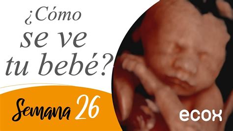 26 Semanas De Gestacion Aboveidea