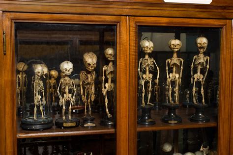 Museo Anatomia Umana Di Torino L Esposizione Dell Mole