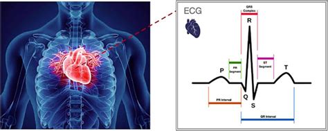 Ecg Signal Adapted From 29 Download Scientific Diagram