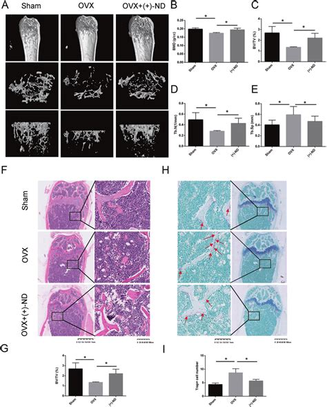 Nd Prevents Ovx Induced Bone Loss In Vivo A Representative