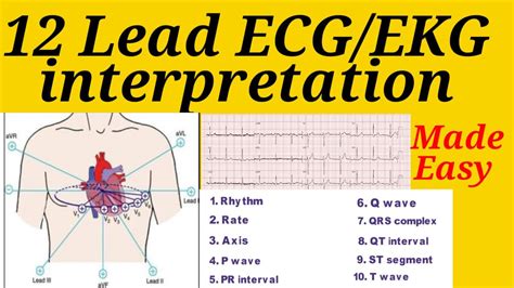 12 Lead Ecgekg Interpretation Made Easy With Simple Steps 12 Lead Ecg Ecg Interpretation