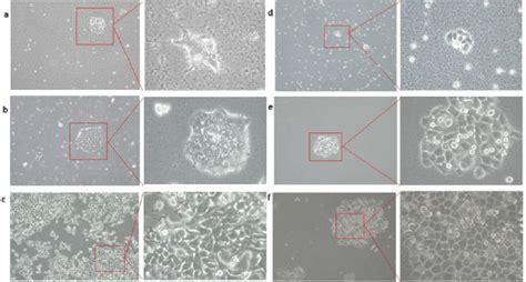 Curing of Bacillus sp. contamination from mammalian cultures. a HEK293T ...