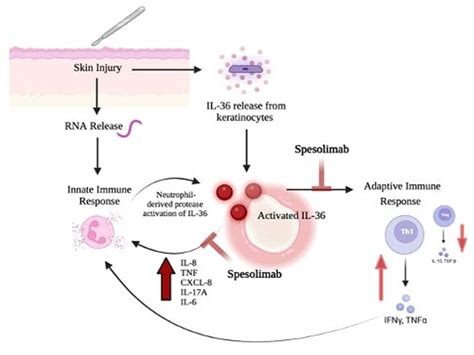 Spesolimab use in treatment of pyoderma gangrenosum | Semantic Scholar