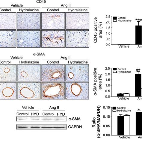 Hydralazine Prevents Angiotensin Ii Infusion Induced Infiltration Of