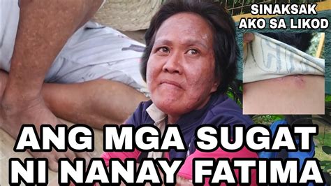 Saan Galing Ang Sugat Si Nanay Fatima Iiwanan Na Daw Nya Si Tatay