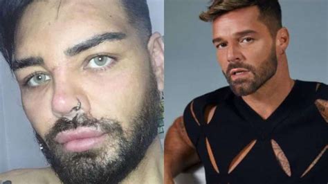 Homem faz 30 cirurgias plásticas para se parecer Ricky Martin veja