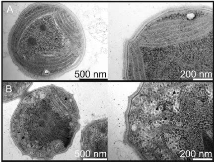 Transmission Electron Microscopy Of The Synechocystis Cells