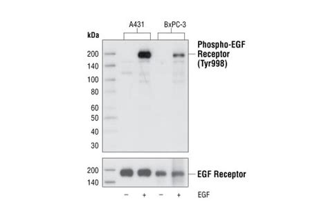 Phospho Egf Receptor Tyr C A Rabbit Mab Cell Signaling