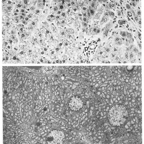 Ultrastructure Of Hepatocytes Of A Rat Primed With Small Dose Cc14 And Download Scientific