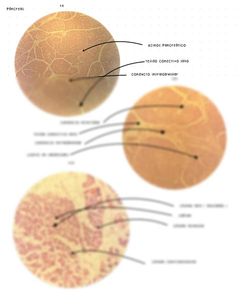SOLUTION Pr Ctica 10 P Ncreas Histolog A Studypool