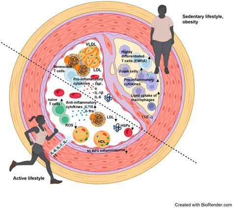 Frontiers Immunological Mechanisms Of Exercise Therapy In Dyslipidemia