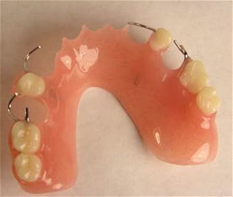 What are Partial Dentures? | Smileinsight Dental - San Diego CA