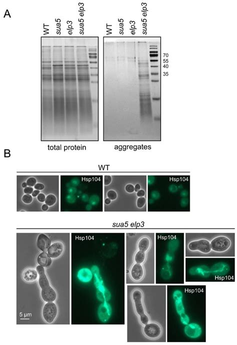 Biomolecules Free Full Text Loss Of Elongator And KEOPS Dependent