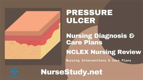 Pressure Ulcer Nursing Diagnosis And Nursing Care Plan Nursestudynet