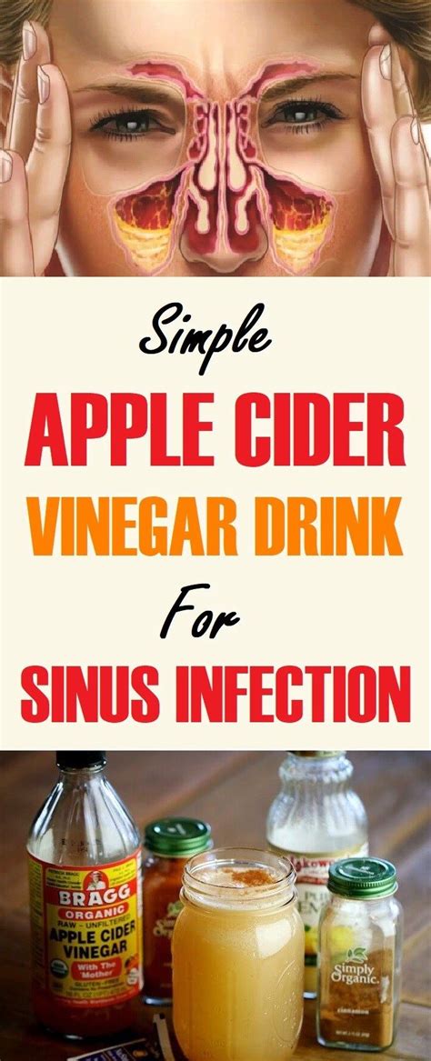 How To Use Apple Cider Vinegar To Treat Sinus Infections Apple Cider Vinegar Remedies Apple