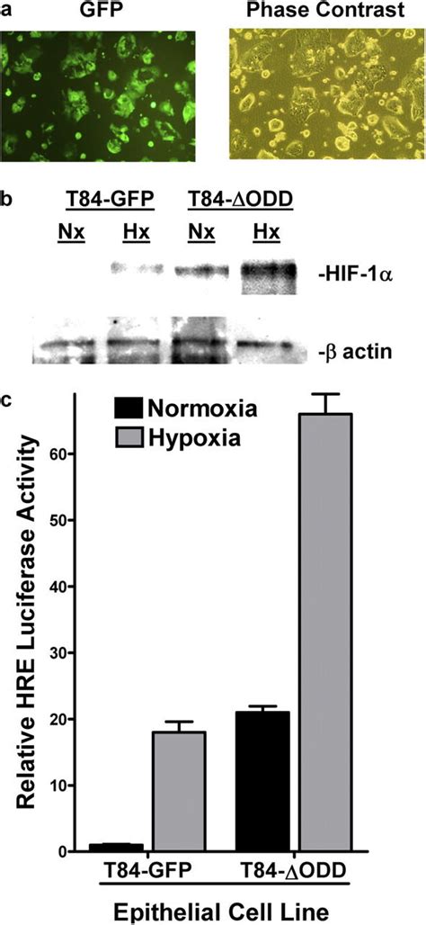 Hif Dependent Repression Of Equilibrative Nucleoside Transporter Ent