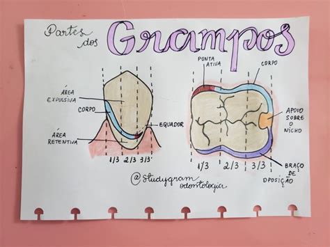 Grampos Ppr Proteseparcial Odonto Odontologia Dentista Desenho