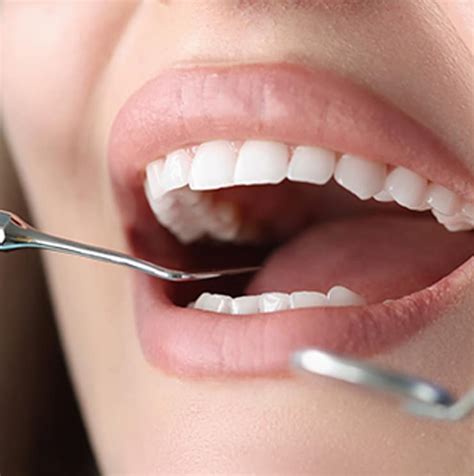 Curetaje dental Restaurando la salud de tus encías Clínica Dental