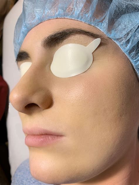 Ipl Eye Shield Disposable Delasco Spa Order