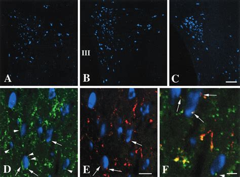 Cart And Msh Ir Innervation Of Pro Trh Mrna Containing Neurons In The