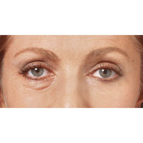 Sudden Change Under-Eye Serum | Carol Wright