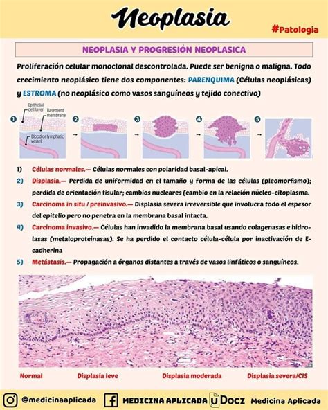 Pin de Andrea Otero en Oncología Tejido conectivo Oncologia Patologia