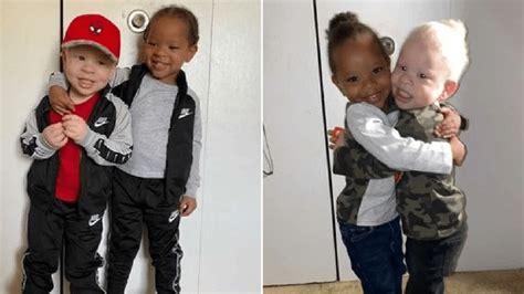 Mother Of One Black One Albino Twins Says People Dont Believe Her Son