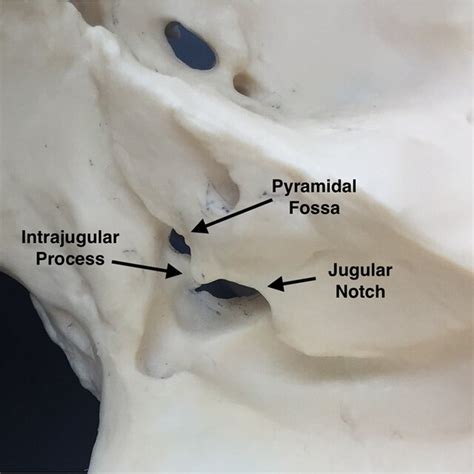 Schematic View Of The Structures Of The Jugular Foramen Carotid Artery