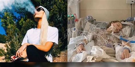 Utah Teen Says Vaping Put Her In A Coma Fox News Video