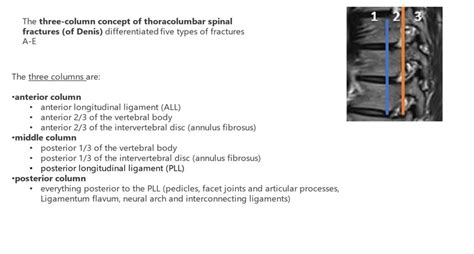 Denis Classification Adapted From Denis Francis Md Frcsc The