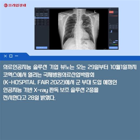 카드 뷰노 인공지능 X Ray 판독 보조 솔루션 2종 선봬 네이트 뉴스